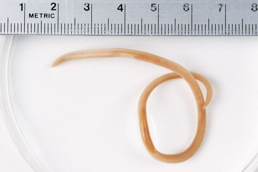 Ascaris é un verme redondo que vive no corpo humano